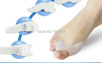 Geriausia parduoti įrankis Nagų Gelis Kojų Išorinis Separatorius Neštuvų Guz Įtvaras Tiesinti Korektorius Koja Hallux Valgus Cure pėdų priežiūra
