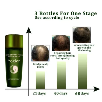 Plaukų Augimą Eterinio Aliejaus, Žolelių Optikos Priežiūros Šampūnas, Plaukų Slinkimas Produktas, Storas Greito Augimo Gydymas